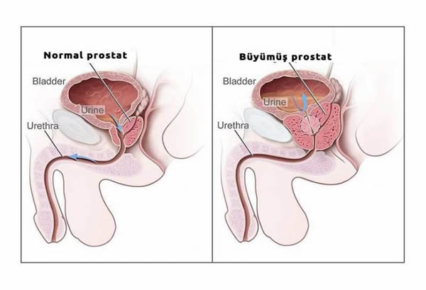 85 yaşında ikiz çocuk sahibi oldu
