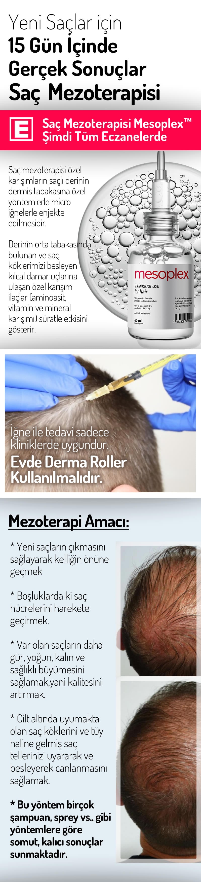 Mesoplex Resmi Satış Sitesi