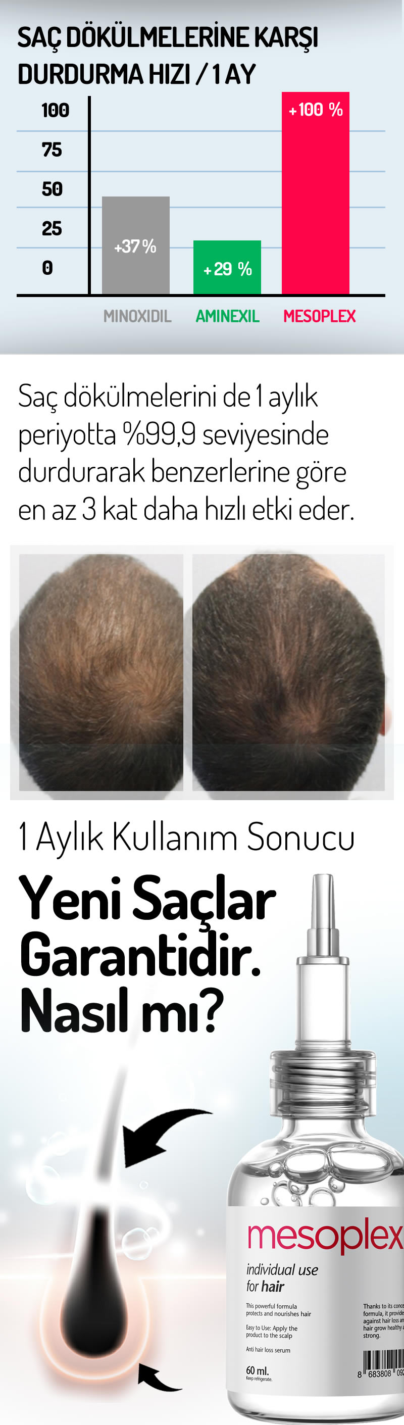 Mesoplex Resmi Satış Sitesi